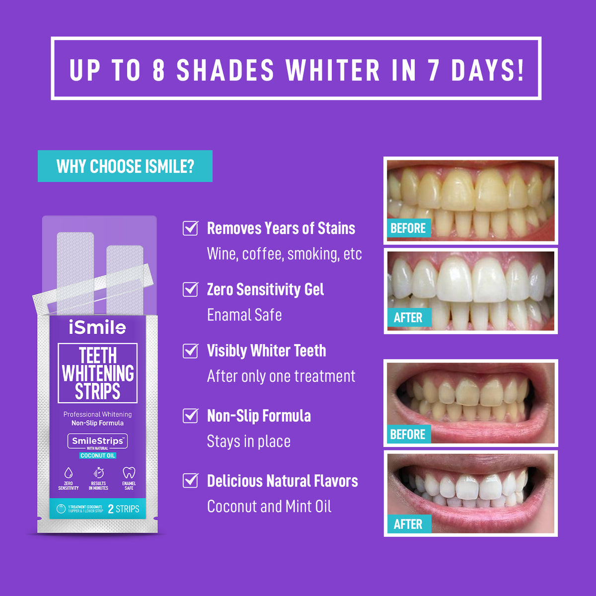 long keep teeth whitening gel